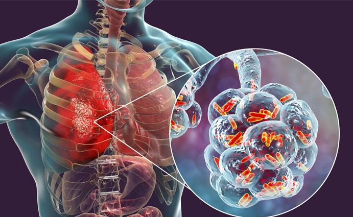 visual of where legionella germs take up residence in a body