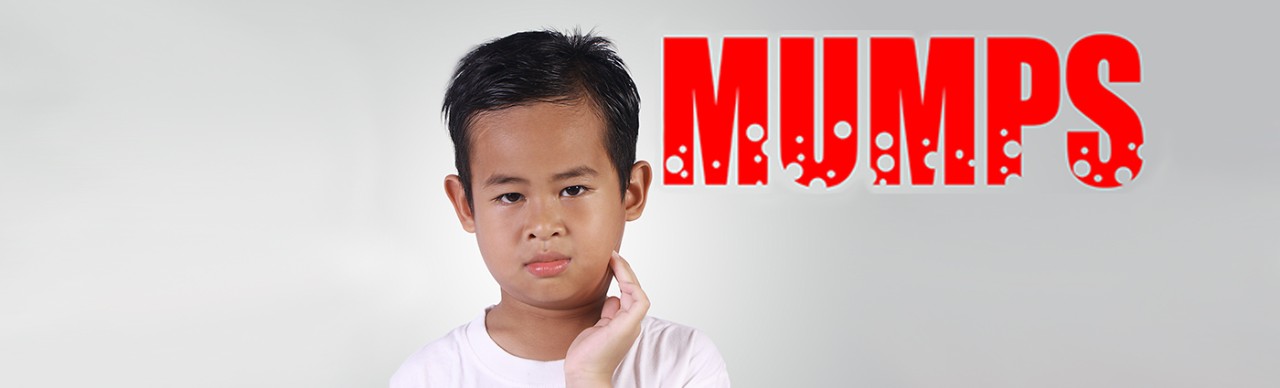 Asian boy with mumps